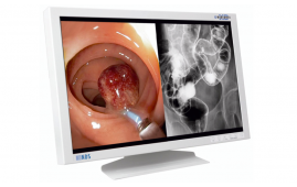 Мониторы для эндоскопии