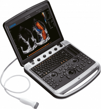 УЗИ аппарат  SONOTOUCH 80 (Sonobook 8)