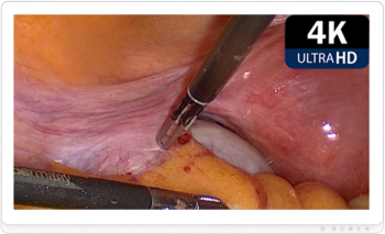 Монитор медицинский KTC 32A30-S