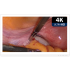 Монитор медицинский KTC 32A30-S