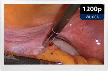 Монитор медицинский KTC 24A30