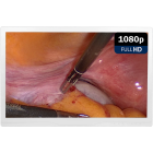 Монитор медицинский KTC 24A25