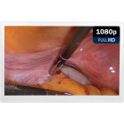 Монитор медицинский KTC 27A31