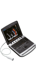 УЗИ аппарат SONOTOUCH 80 (Sonobook 6)