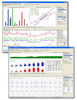 Экранные формы ЭКГ и АД